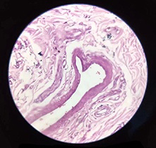 A skin cell slide seen under a microscope.